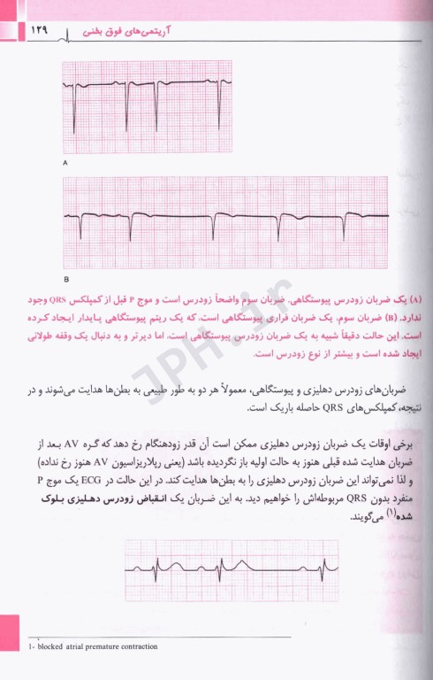 تنها کتاب EKG که نیاز دارید 2023 دکتر قارونی