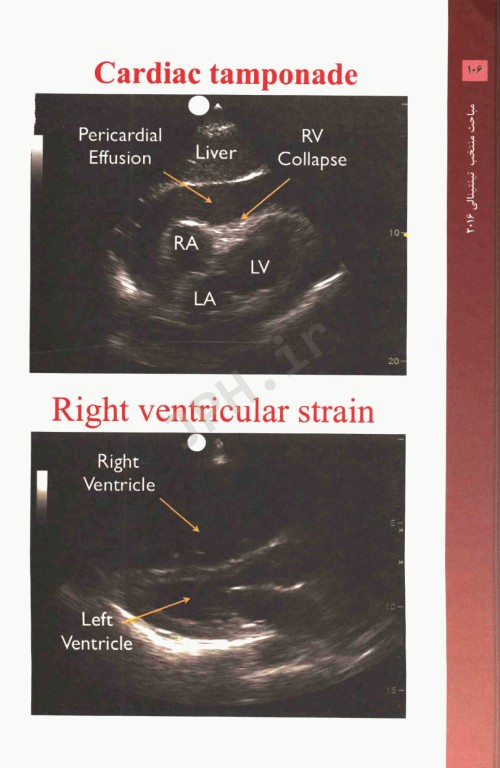 مجموعه ترجمه و تلخیص دانشنامه طب اورژانس مباحث منتخب تینتینالی 2016