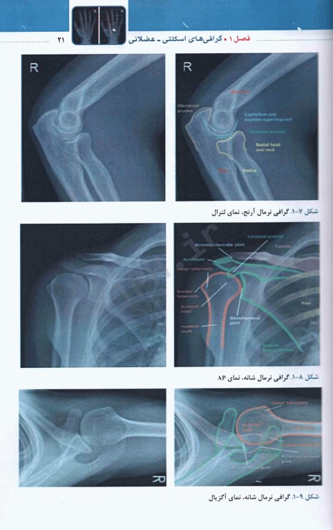 تفسیر آسان گرافی‌های اسکلتی عضلانی