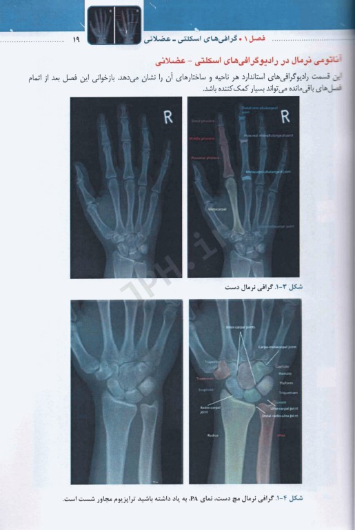 تفسیر آسان گرافی‌های اسکلتی عضلانی