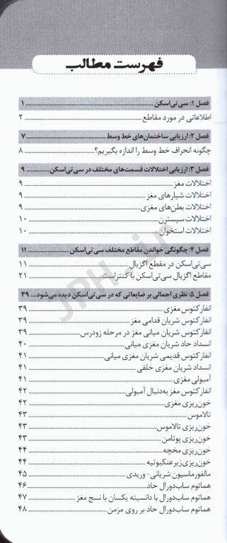 تفسیر آسان سی‌ تی اسکن مغز