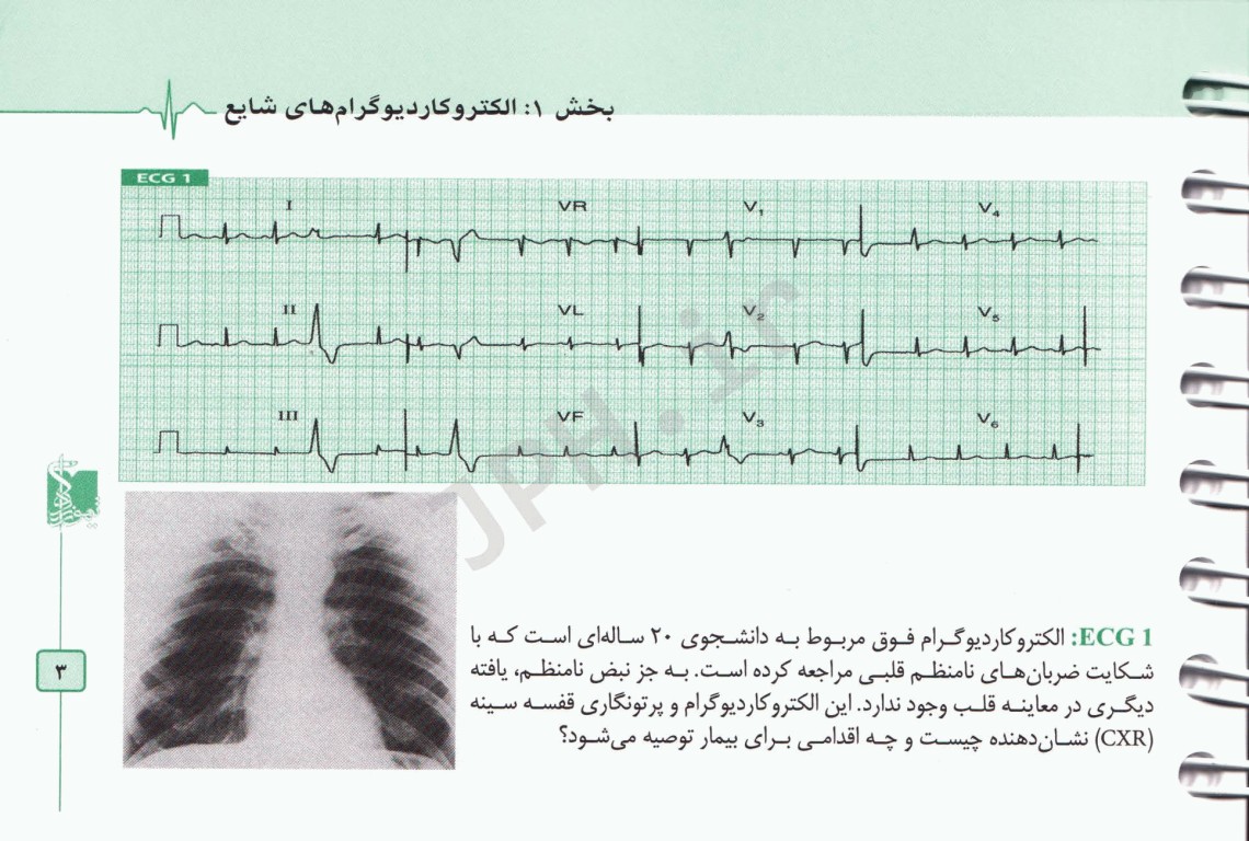 150 الکتروکاردیوگرام ECG بالینی ویراست پنجم ترجمه دکتر انوش دهنادی‌مقدم