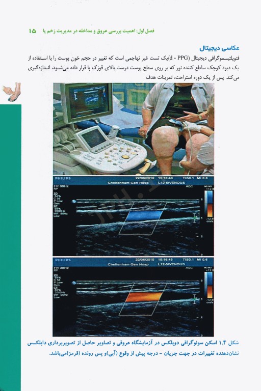 اندازه‌گیری التیام زخم علم و عمل