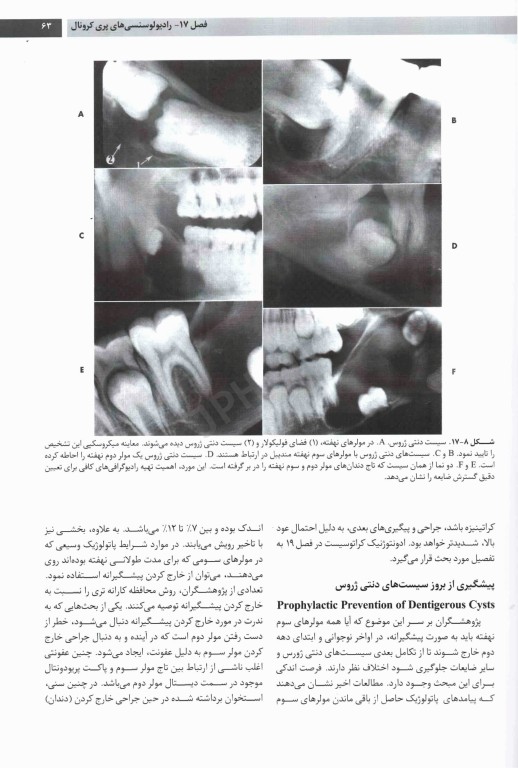 تشخیص افتراقی ضایعات استخوانی دهان، فک و صورت