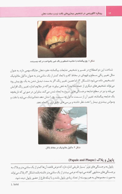 رویکرد الگوریتمی در تشخیص بیماری‌های بافت نرم و سخت دهان