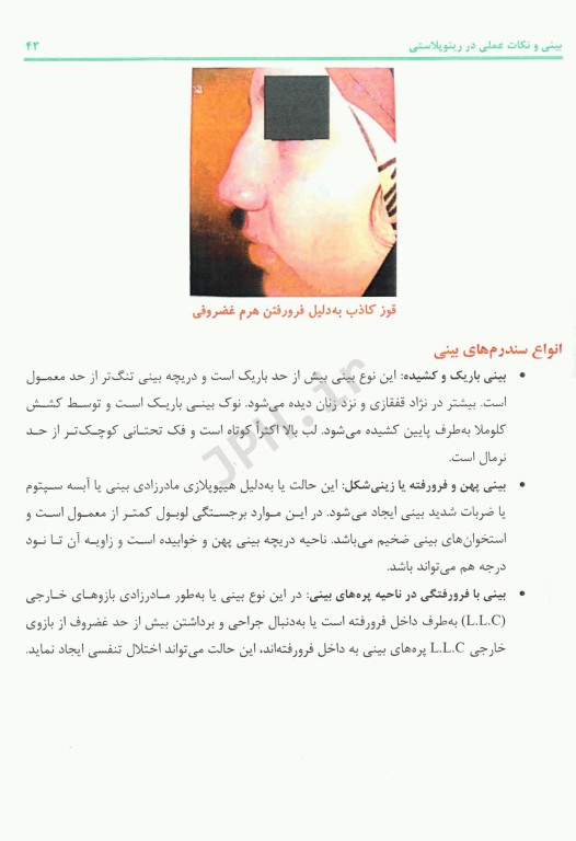 بینی و نکات عملی در رینوپلاستی
