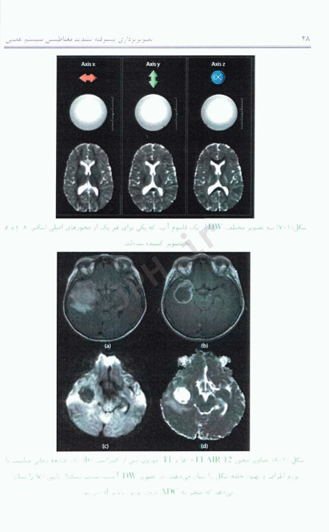 تصویربرداری پیشرفته تشدید مغناطیسی سیستم عصبی از مبانی نظری تا کاربردهای بالینی