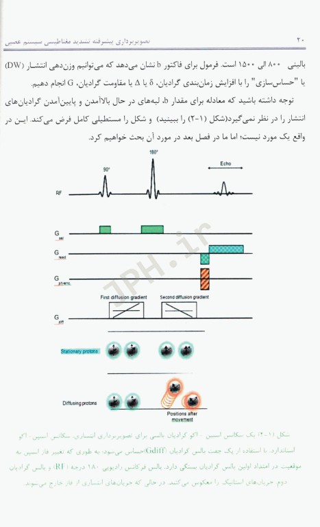 تصویربرداری پیشرفته تشدید مغناطیسی سیستم عصبی از مبانی نظری تا کاربردهای بالینی