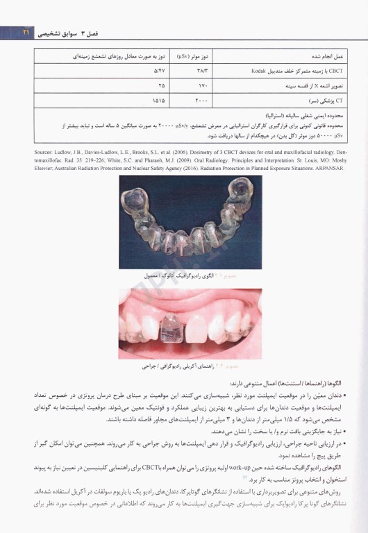 روش‌های کاربردی در دندانپزشکی ایمپلنت 2021