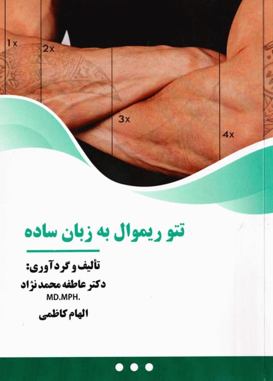 تتو ریمووال به زبان ساده