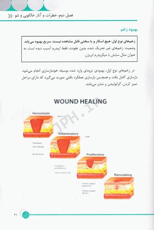 تتو ریمووال به زبان ساده