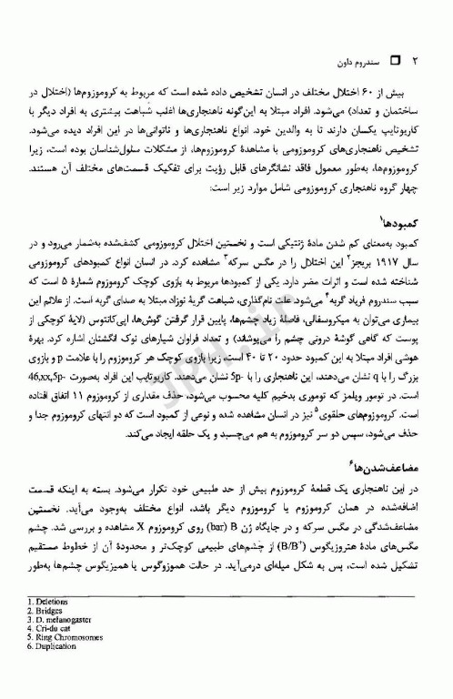 اختلال در کروموزوم‌ها سندروم داون