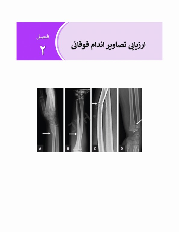 ارزیابی تصاویر پزشکی در اورژانس رادیولوژی، سی تی اسکن و MRI