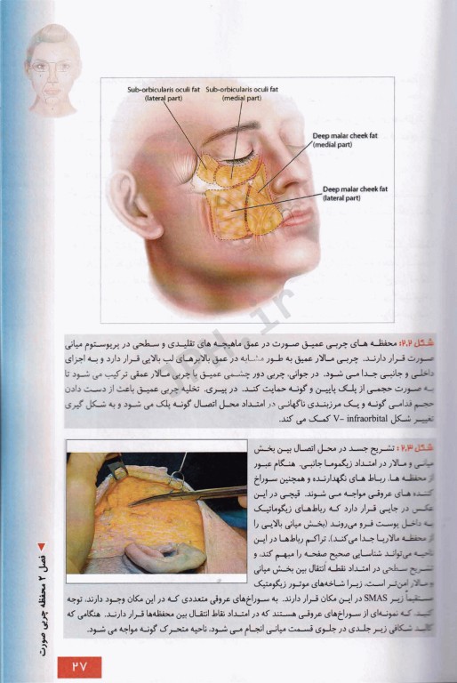 منطقه خطر صورت