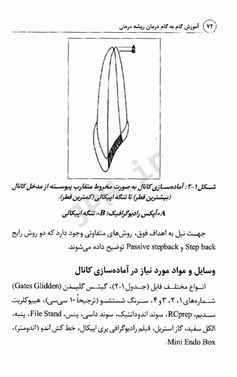 آموزش گام به گام درمان ریشه دندان