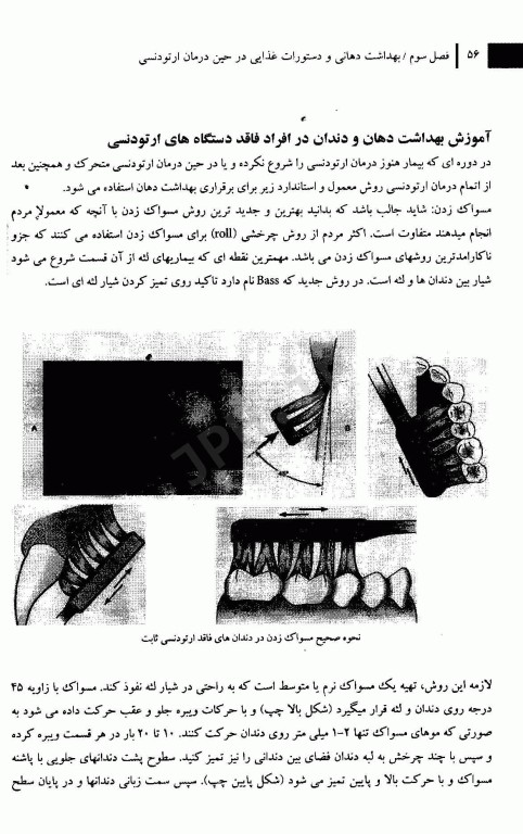 آشنایی مقدماتی با ارتودنسی وسایل و واژه‌های رایج در این علم