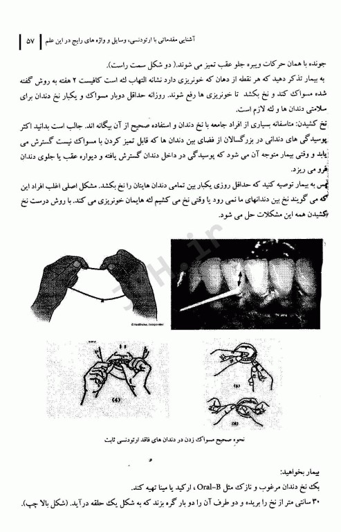 آشنایی مقدماتی با ارتودنسی وسایل و واژه‌های رایج در این علم