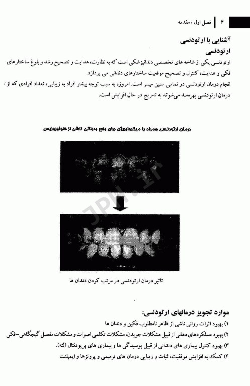 آشنایی مقدماتی با ارتودنسی وسایل و واژه‌های رایج در این علم