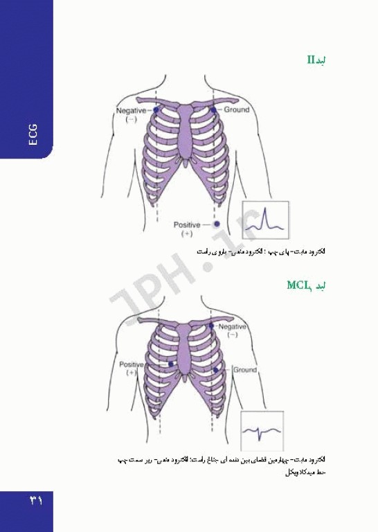 PDQ برای مراقبت‌های ویژه