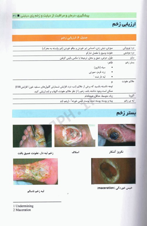 پیشگیری، درمان و مراقبت از دیابت و زخم پای دیابتی