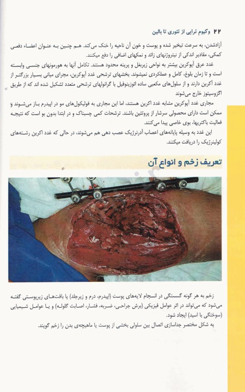 وکیوم تراپی از تئوری تا بالین