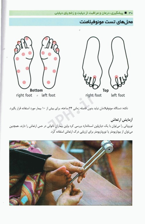 پیشگیری، درمان و مراقبت از دیابت و زخم پای دیابتی