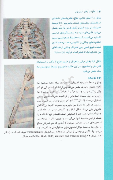 عفونت زخم استرنوم