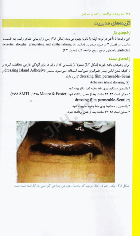 مدیریت و مراقبت از زخم در سرطان