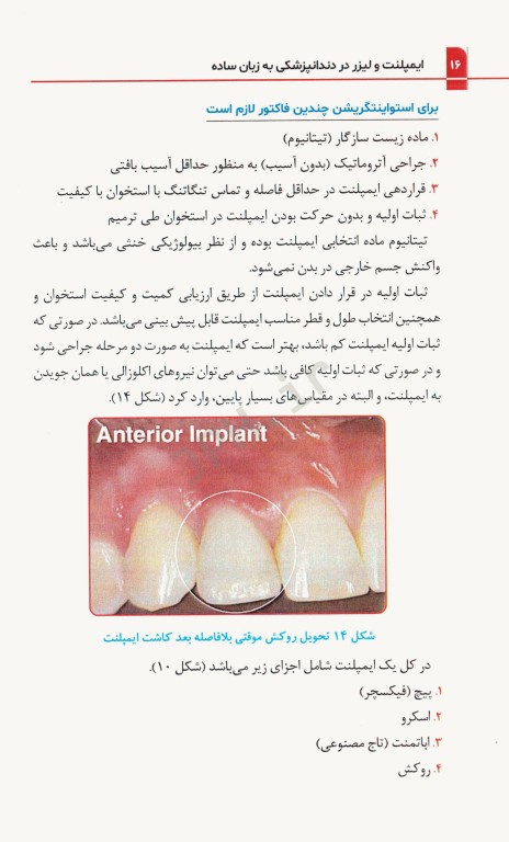 ایمپلنت و لیزر در دندانپزشکی به زبان ساده