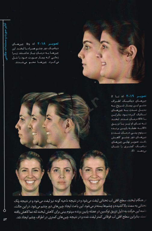 توکسین بوتولینوم برای هارمونی صورت 2018 ترجمه دکتر داوود رمزی