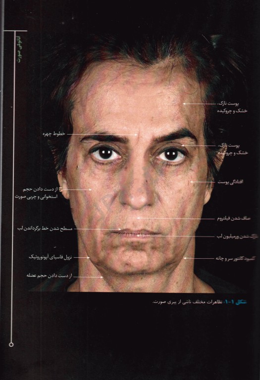 تزریق فیلر برای هارمونی صورت 2019 ترجمه دکتر داوود رمزی