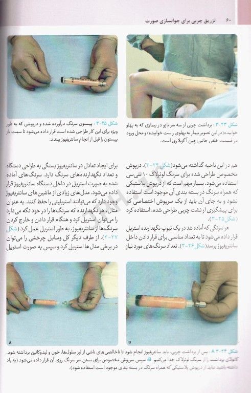 تزریق چربی برای جوانسازی صورت ترجمه دکتر داوود رمزی