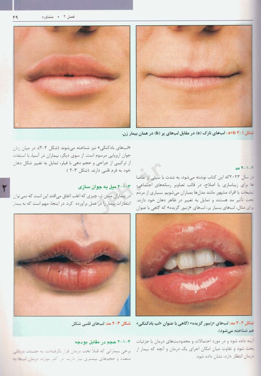 راهنمای مصور تکنیک‌های تزریق فیلر لب ترجمه دکتر داوود رمزی
