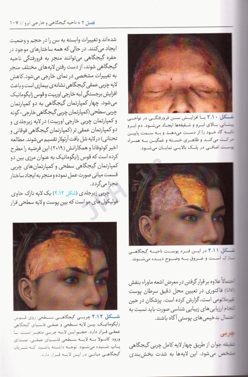 ضروریات آناتومی در تزریق‌های زیبایی صورت 2020 ترجمه دکتر داوود رمزی