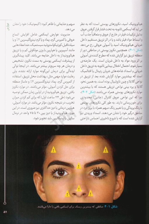 تزریق فیلر برای هارمونی صورت 2019 ترجمه دکتر داوود رمزی