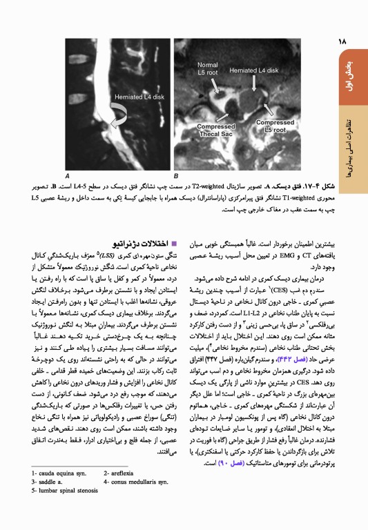 اصول طب داخلی هاریسون 2022 بیماری‌های روماتولوژی و دستگاه ایمنی