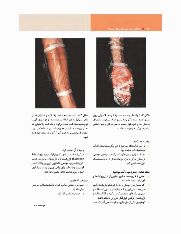 تشخیص و درمان بیماری‌های پوست هبیف 2017