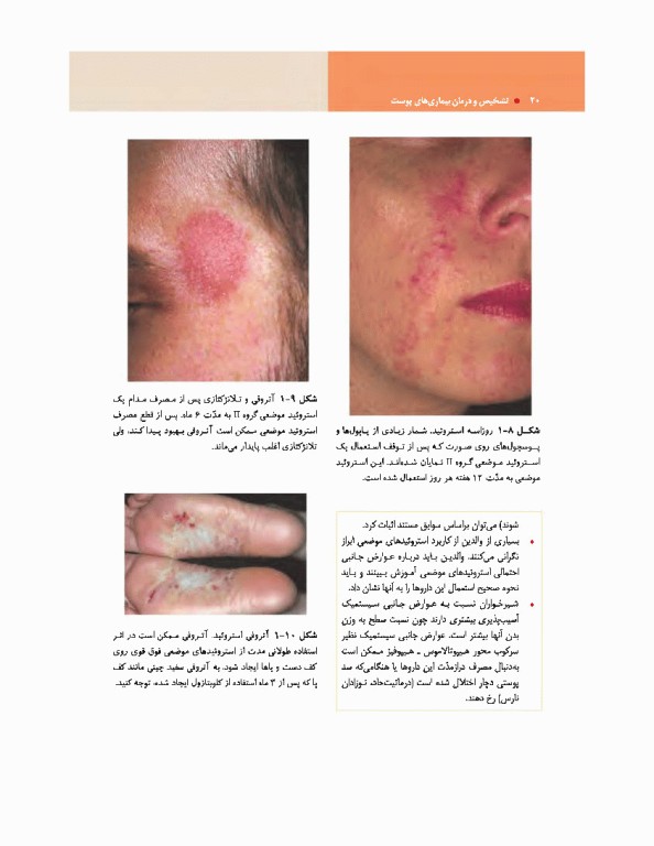 تشخیص و درمان بیماری‌های پوست هبیف 2017