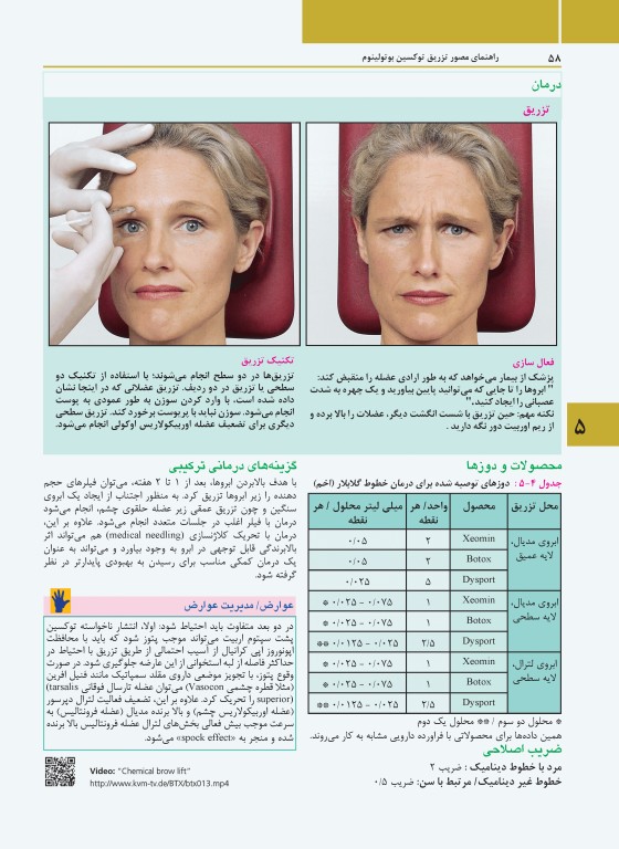 راهنمای مصور تزریق توکسین بوتولینوم دکتر داوود رمزی