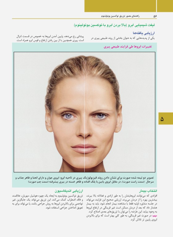 راهنمای مصور تزریق توکسین بوتولینوم دکتر داوود رمزی