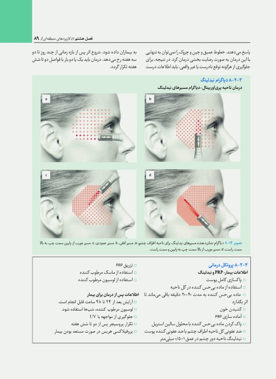 راهنمای مصور PRP دکتر داوود رمزی