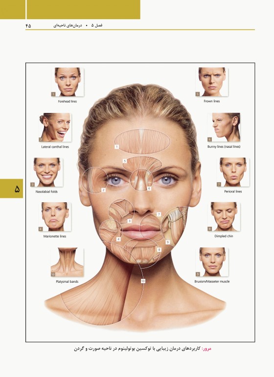 راهنمای مصور تزریق توکسین بوتولینوم دکتر داوود رمزی