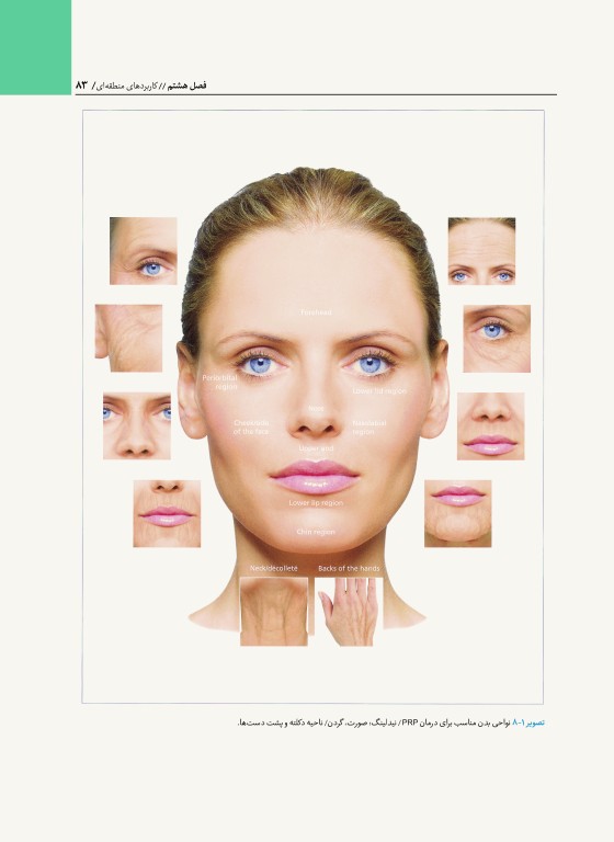 راهنمای مصور PRP دکتر داوود رمزی