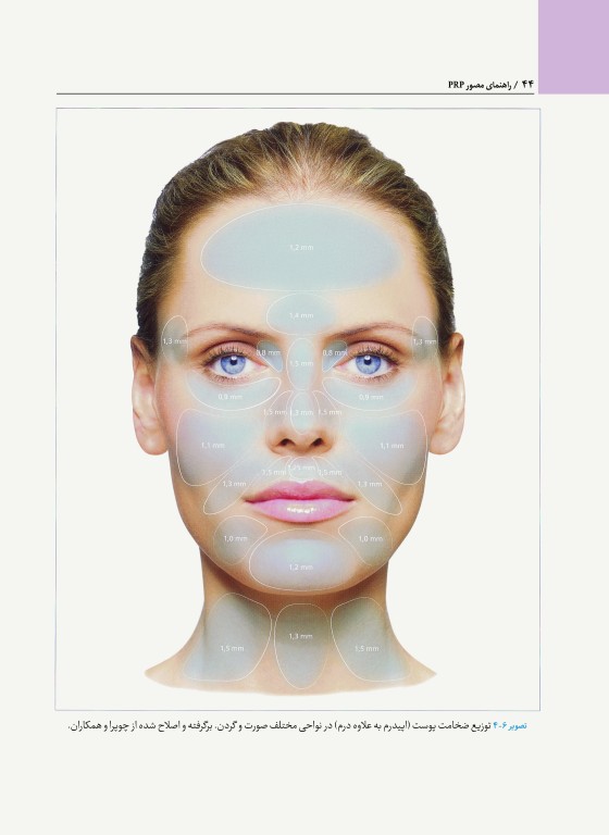 راهنمای مصور PRP دکتر داوود رمزی