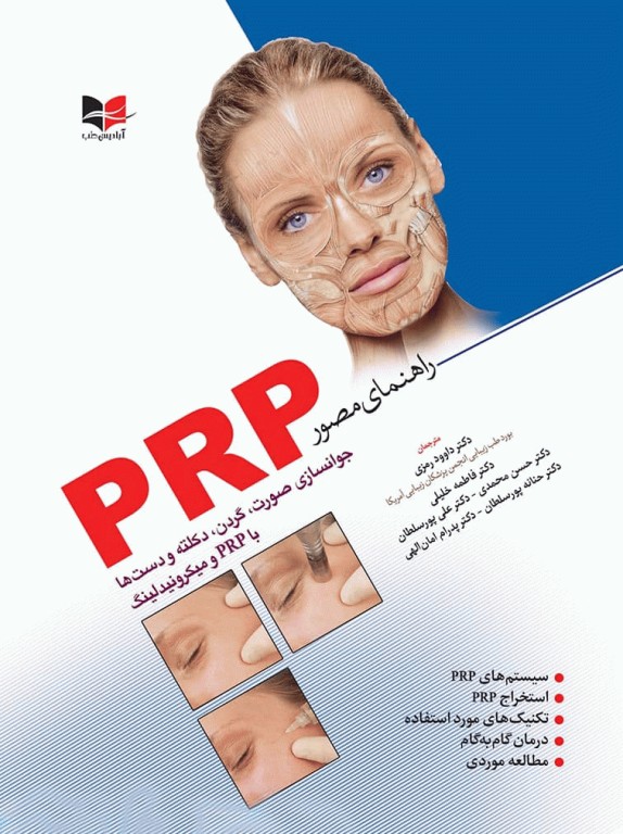 راهنمای مصور PRP دکتر داوود رمزی