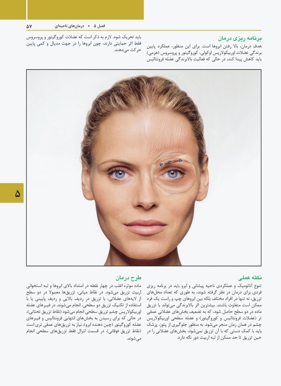 راهنمای مصور تزریق توکسین بوتولینوم دکتر داوود رمزی