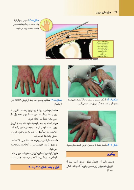 جوان‌سازی تزریقی دکتر داوود رمزی