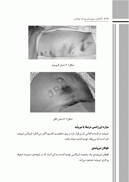 گام‌های سریع برای پرستاری اورژانس 2022