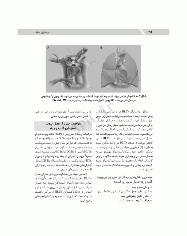 پرستاری پیوند ویراست دوم