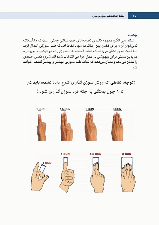 نقاط اضافه طب سوزنی بدن